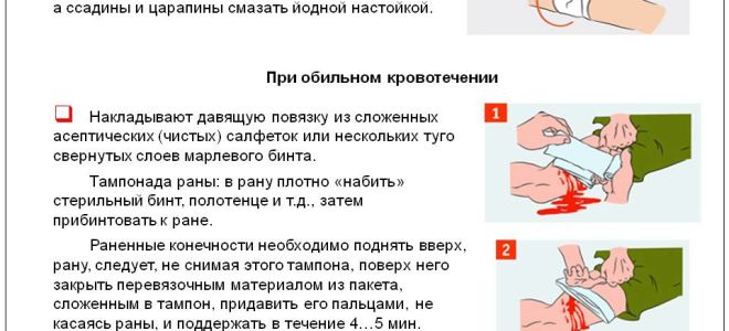 Как действовать, если из пролежня течет кровь: разновидности, причины появления и процесс лечения.