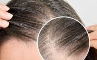 Причины поседения волос у мужчин и женщин