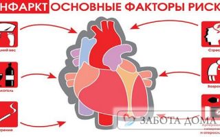 Смерть от инфаркта миокарда и ее основные причины