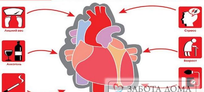 Смерть от инфаркта миокарда и ее основные причины