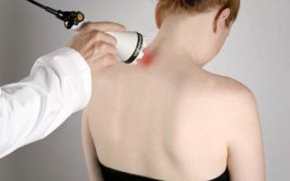 Как лечить миозит мышц спины: лекарственные препараты и физиотерапия