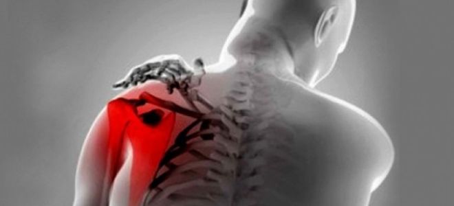 Причины развития тендита сухожилий коленного сустава: большие физические нагрузки и травмы
