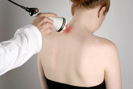 Как лечить миозит мышц спины: лекарственные препараты и физиотерапия