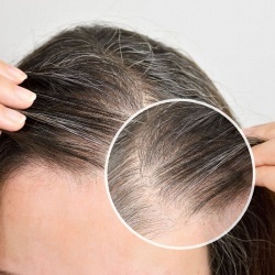 Причины поседения волос у мужчин и женщин