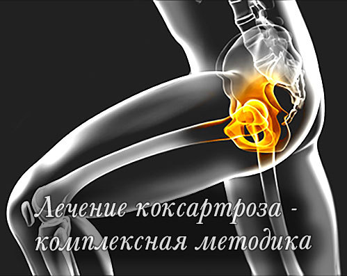 Лечение народными средствами коксартроза тазобедренного сустава