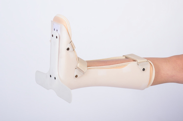 Виды наколенников при артрозе коленного сустава: закрытые и открытые