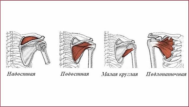 Причины развития тендинита сухожилия надостной мышцы плеча: травмы и огромные нагрузки