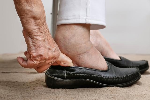 Отек ног у пожилых людей: что делать в первую очередь