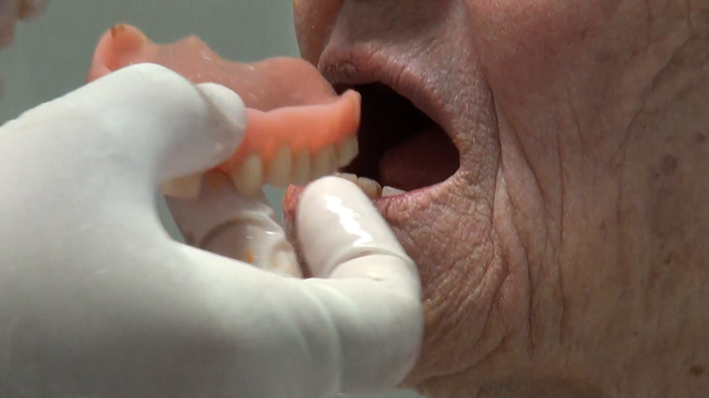 Бесплатное протезирование зубов для пенсионеров: где пройти процедуру в вашем городе?